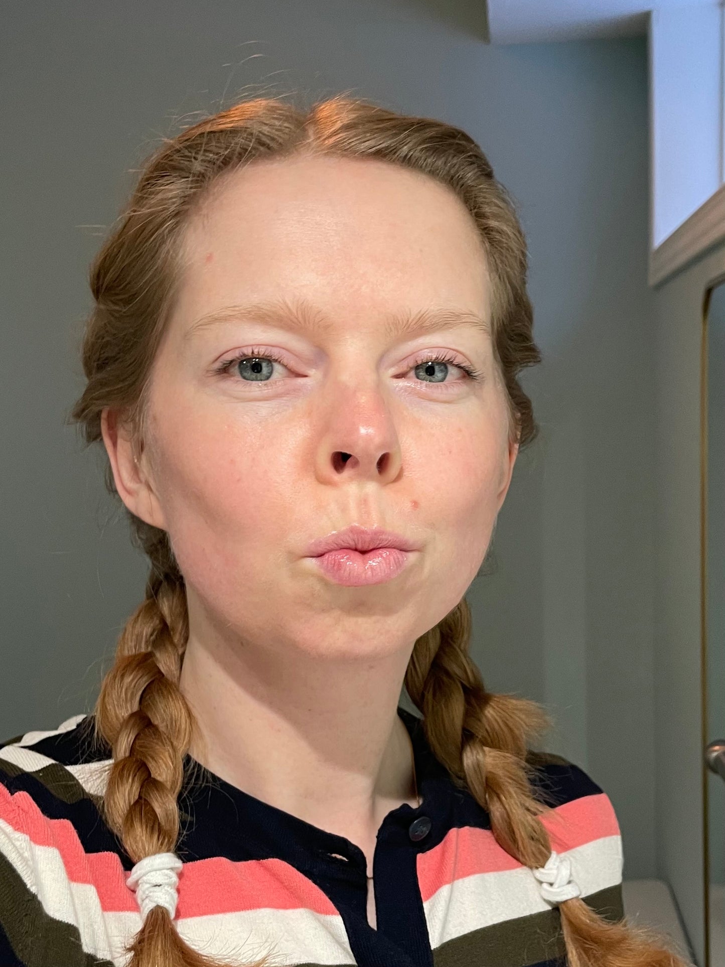 Lip Rescue Duo – Exfoliate & Nourish